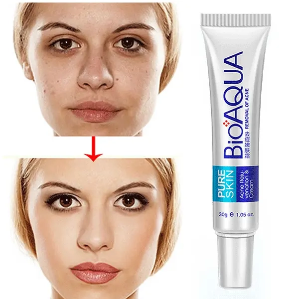 کرم ضد جوش بیواکوا BioAQUA