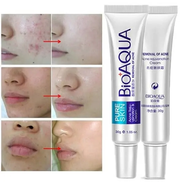 کرم ضد جوش بیواکوا BioAQUA